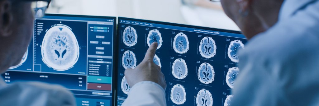 Strategia Naţională pentru Combaterea Bolilor Cerebrovasculare se lansează la Cluj-Napoca