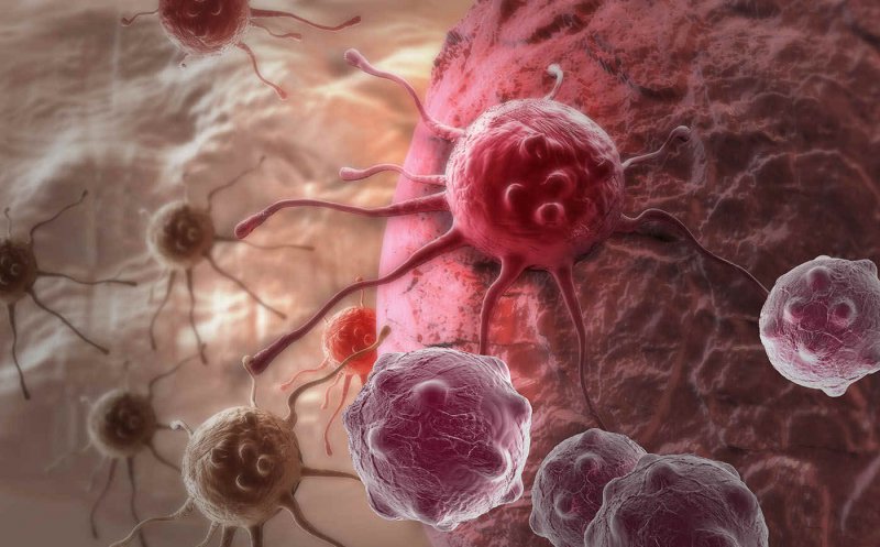 Experți: Europa se îndreaptă către o "epidemie de cancer"