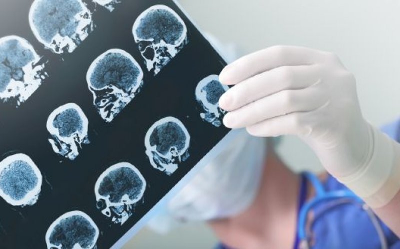 Cercetători: Creierele adolescenților care au avut COVID prezintă semne de îmbătrânire accelerată