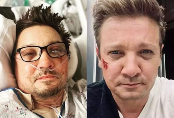 Ce a pățit, de fapt, Jeremy Renner în timp ce curăța zăpada: "Am peste 30 de oase rupte"