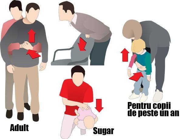 Eleva din Cluj care a decedat după ce s-a înecat cu un jeleu putea fi salvată. Medic: "Românii mor fără a li se aplica la timp manevra salvatoare"