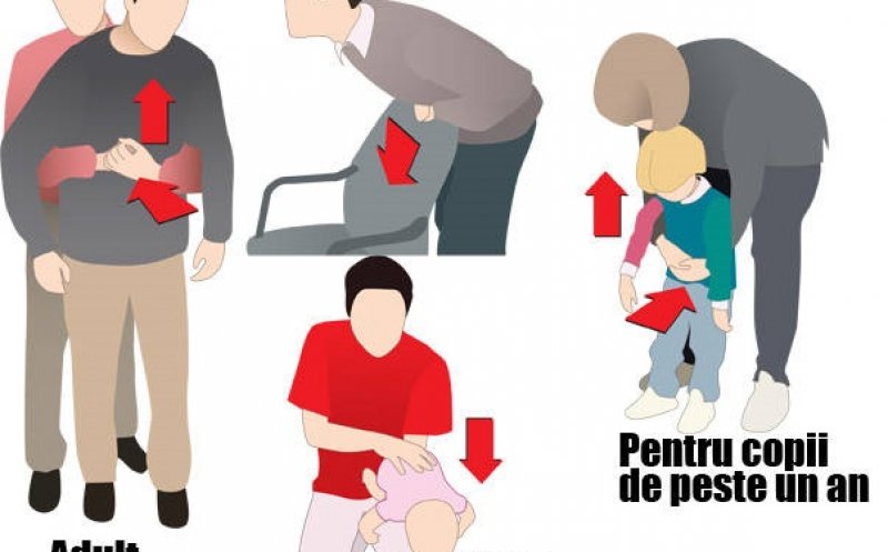 Eleva din Cluj care a decedat după ce s-a înecat cu un jeleu putea fi salvată. Medic: "Românii mor fără a li se aplica la timp manevra salvatoare"