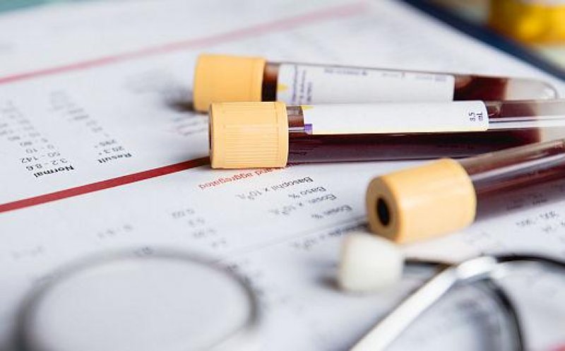 Analizele de sânge de rutină ar putea indica riscul crescut de Alzheimer sau demență