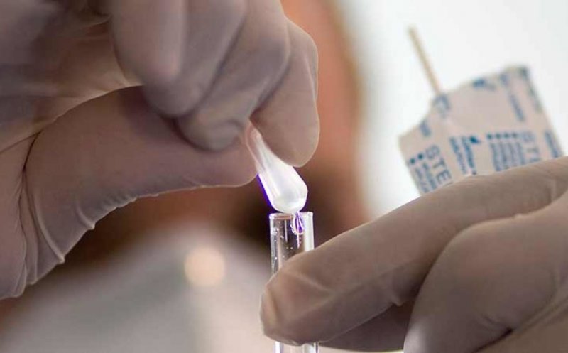 A fost lansat un test de sânge care îți spune dacă riști să faci Alzheimer. Cât costă și cum te testezi acasă