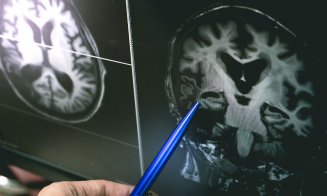 Au fost identificați peste zece factori-cheie de risc pentru demenţă. Aceștia pot prezice dacă persoana va dezvolta boala în următorii ani