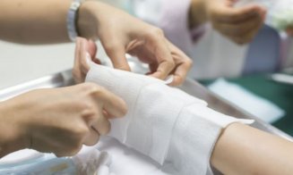 Pacienţii cu arsuri vor avea acces la servicii de consiliere psihologică, psihoterapie și fizioterapie