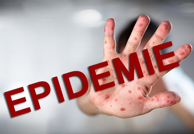 Ministerul Sănătății a declarat EPIDEMIE de rujeolă în România. Clujul, în topul îmbolnăvirilor