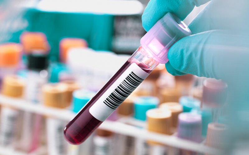Maladia Alzheimer ar putea fi depistată înainte de apariția primelor semne cu un test de sânge