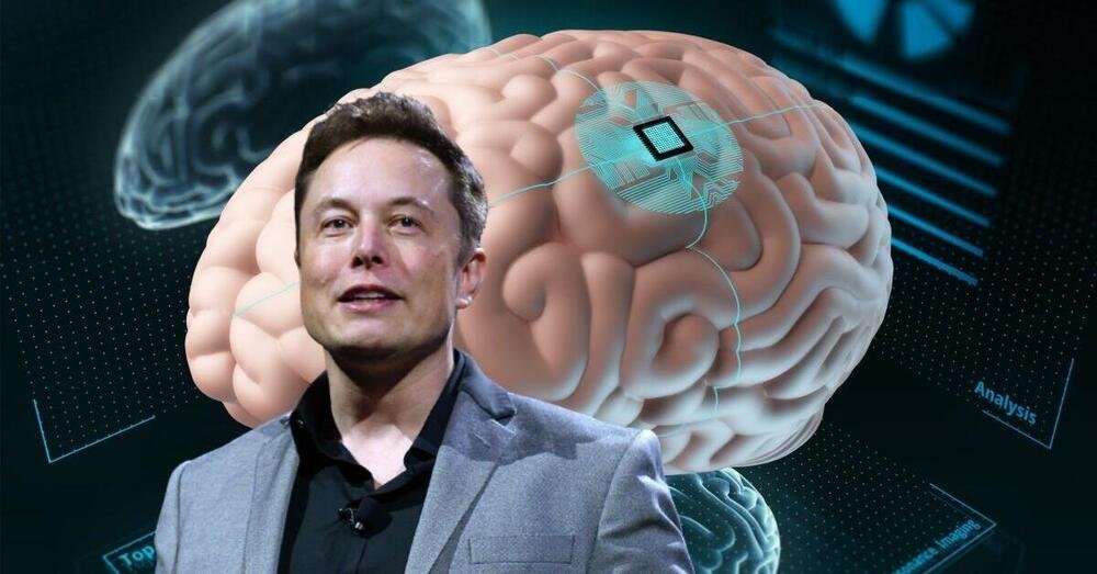Implantul Neuralink funcționează. Primul pacient cu cip-ul lui Elon Musk poate controla mouse-ul cu gândul