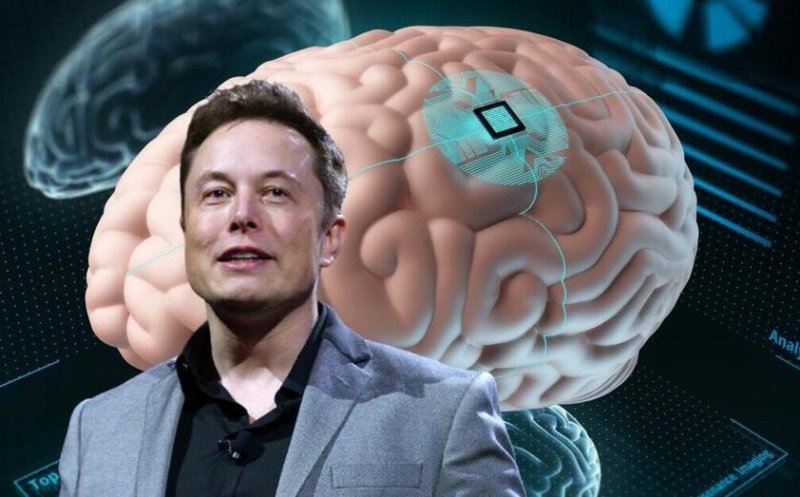 Implantul Neuralink funcționează. Primul pacient cu cip-ul lui Elon Musk poate controla mouse-ul cu gândul