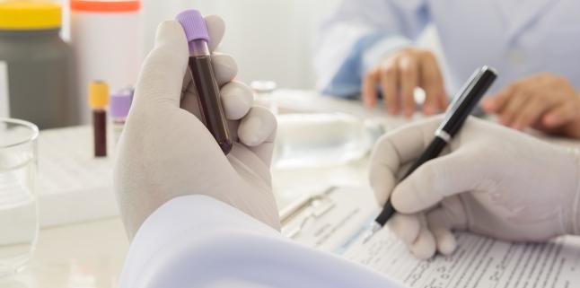 O analiză de sânge ar putea avertiza asupra cancerului cu 7 ani înainte de diagnosticare