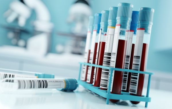 Boala Parkinson ar putea fi prezisă cu 7 ani înainte de apariţia primelor simptome