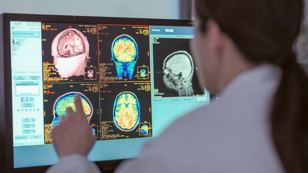 Un instrument AI poate prezice boala Alzheimer din tiparele de vorbire