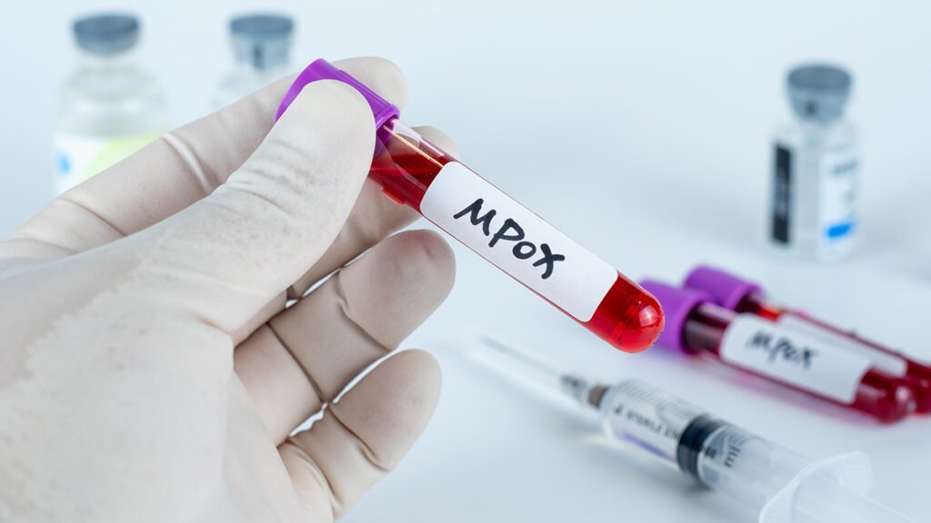 Încă un caz cu noua tulpină de mpox în Europa. ECDC anunță că „monitorizează îndeaproape situația”