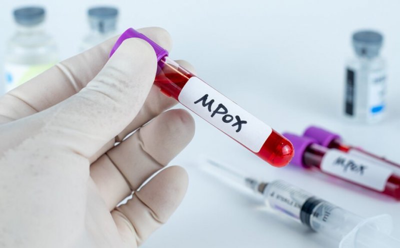 Încă un caz cu noua tulpină de mpox în Europa. ECDC anunță că „monitorizează îndeaproape situația”