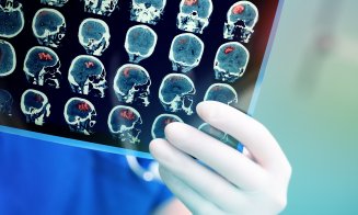 Vești bune: 8 din 10 AVC-uri pot fi prevenite! E nevoie doar de mici modificări în stilul de viaţă