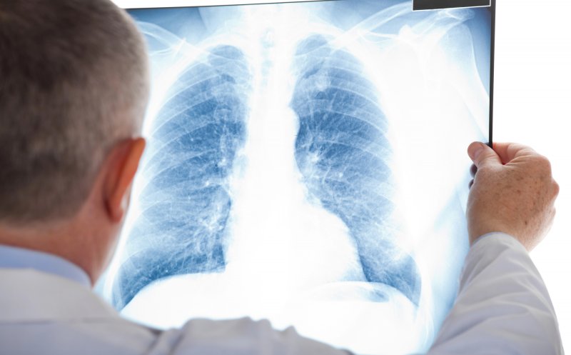 Primul test de urină care ar putea detecta cancerul pulmonar. În ce fază sunt testele