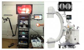 Noi investiții în aparatură medicală la SCJU Cluj. Mare parte din echipamente, pentru secțiile de Ortopedie