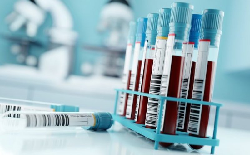 Vești bune! Un nou test de sânge pentru detectarea precoce a cancerului, validat cu succes în studiile clinice