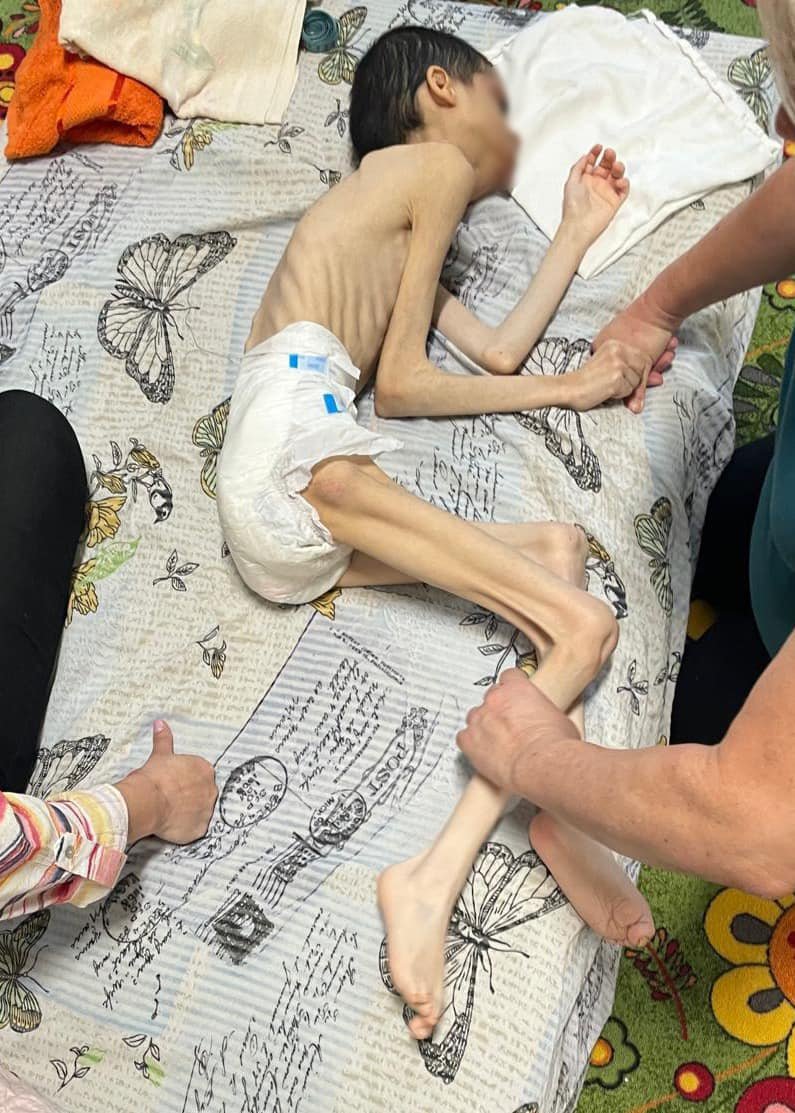 Vă amintiți de orfelinatele groazei, descoperite după '89? Se pare că nu au dispărut... Imagini ȘOCANTE din niște centre de plasament, aflate la 100 km de Cluj