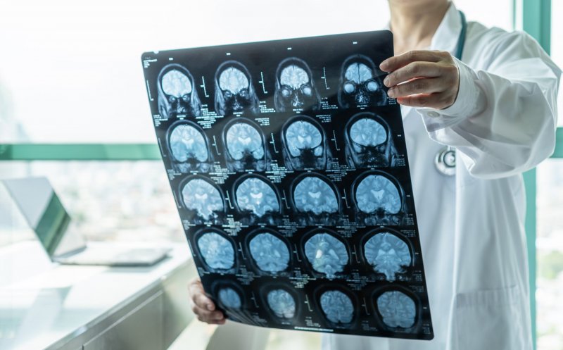Aproape jumătate dintre persoane ar putea dezvolta demenţă după 55 de ani. Cum se poate reduce acest risc