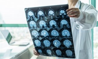 Aproape jumătate dintre persoane ar putea dezvolta demenţă după 55 de ani. Cum se poate reduce acest risc