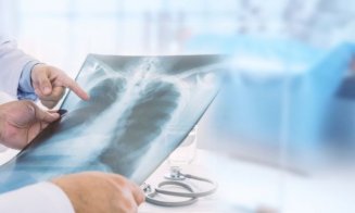 Medic: 80% din cancerul bronho-pulmonar îl depistăm după ce a trecut o infecţie respiratorie/ Cum poți face un prescreening orientativ acasă