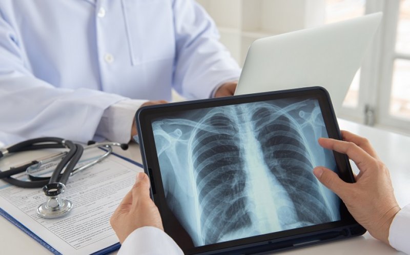 Cazurile de cancer pulmonar, în creştere în rândul nefumătorilor din întreaga lume. Care ar fi explicația