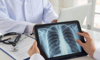 Cazurile de cancer pulmonar, în creştere în rândul nefumătorilor din întreaga lume. Care ar fi explicația