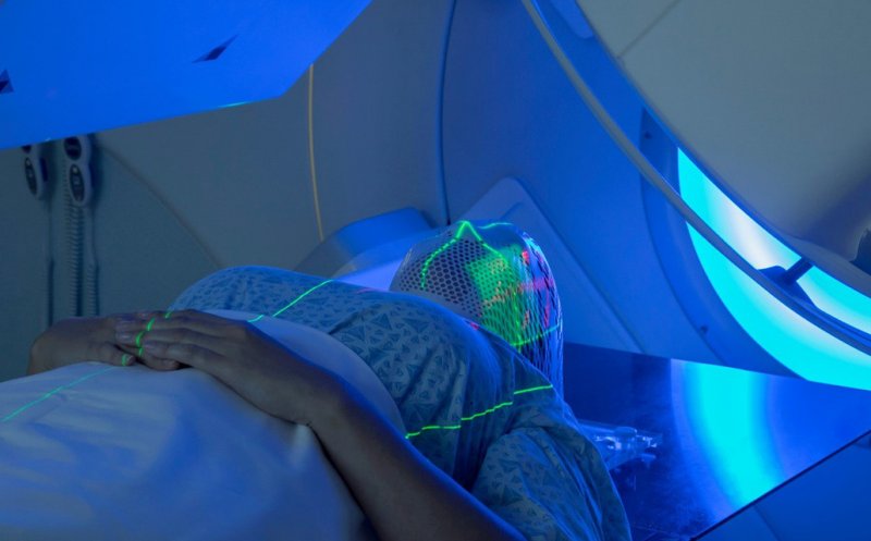 De ce mor diferit celulele canceroase după tratamentul cu radiaţii?