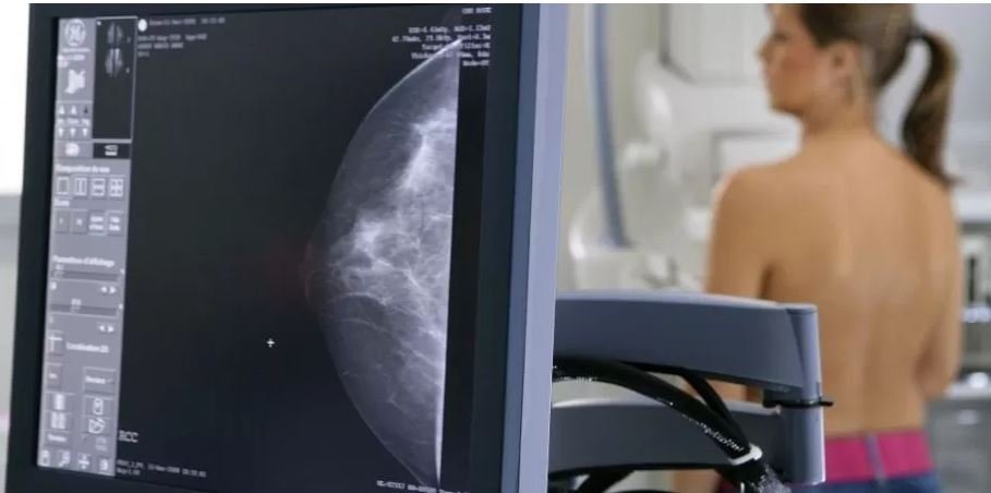 Numărul deceselor provocate de cancerul de sân, în creştere la nivel mondial/ La fiecare minut, o femeie e diagnosticată cu această boală