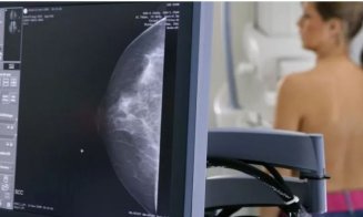 Numărul deceselor provocate de cancerul de sân, în creştere la nivel mondial/ La fiecare minut, o femeie e diagnosticată cu această boală