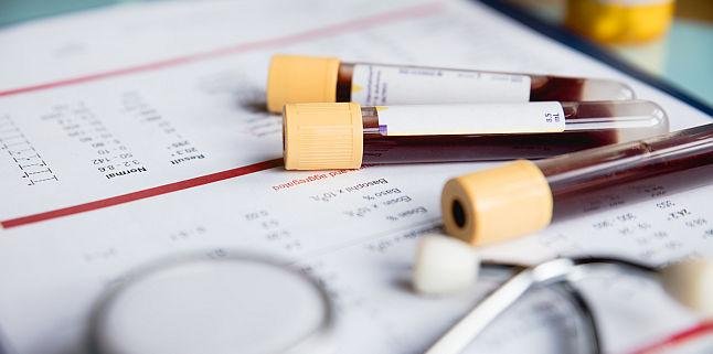 32 milioane de euro pentru campanii ce vizează hepatitele virale/ Cine va beneficia de screening pentru B și C