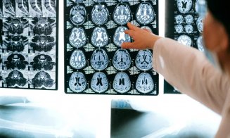 Prevenția AVC: 8 metode esențiale pentru a reduce riscul de accident vascular cerebral