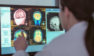 Unele persoanele ar fi mai puțin predispuse la demență. Iată ce arată un studiu