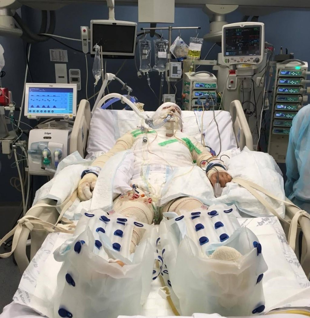 Infecțiile nosocomiale NU apar în foile de observație ale pacienților din Centrul de Arși de la Floreasca. Șeful Secției a fost DEMIS