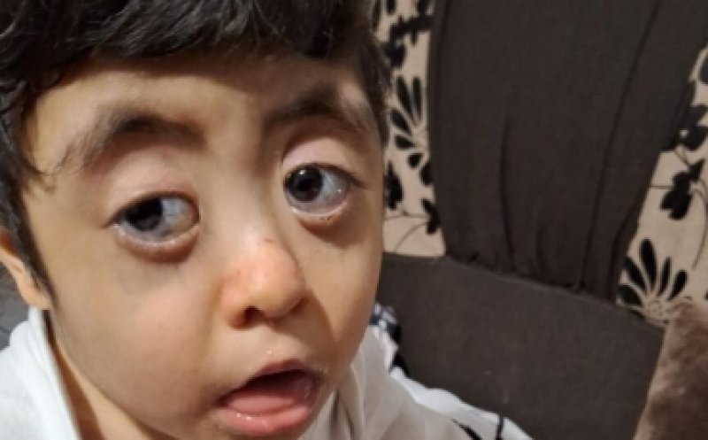 Salvează o inimă! Adelin are 6 ani și se luptă pentru fiecare respirație. Operația care-i poate salva viața costă 10.000 de euro