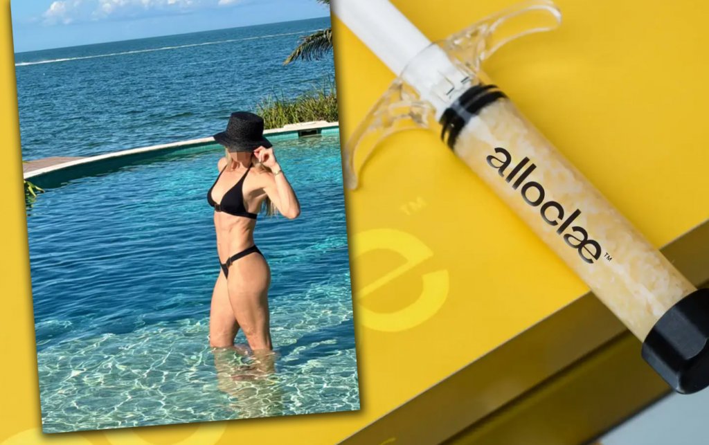 Procedură MACABRĂ pentru corpul perfect: Grăsime injectată de la donatori decedați / „Reciclăm”