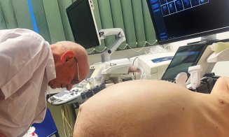 Intervenție spectaculoasă la SCJU Cluj! O echipă de chirurgi a îndepărtat o tumoră de 25 kg într-o operație de mare risc
