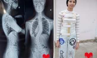 „Fiecare zi îmi curbează coloana tot mai mult”. Erika, o adolescentă de 15 ani, are nevoie urgent de o operație pentru a putea trăi fără durere