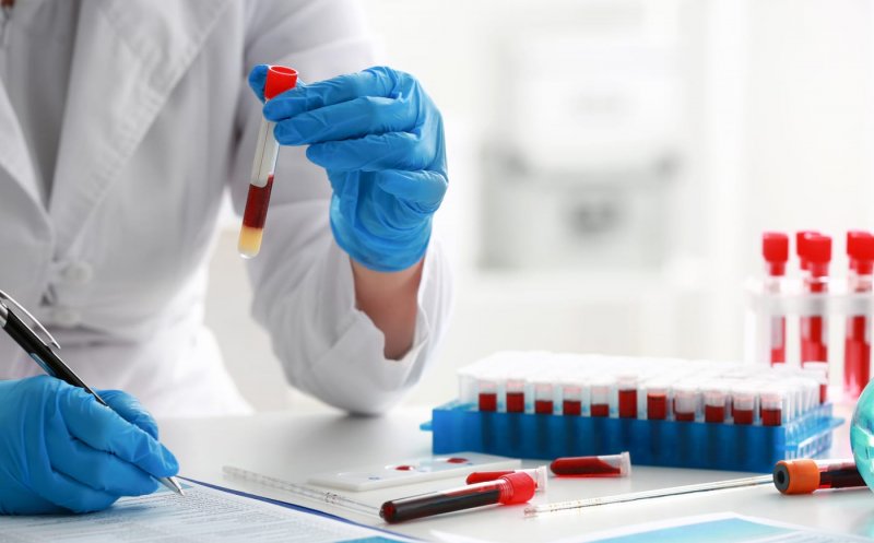 Noi biomarkeri pentru detectarea cancerului. Ar fi chiar mai preciși decât testele existente