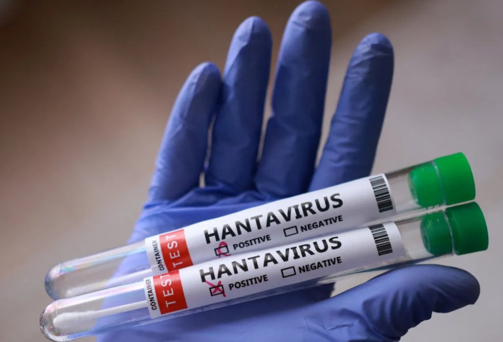 Încă o persoană care a fost pe vasul MV Hondius a fost confirmată cu hantavirus