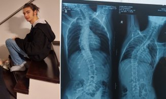 „Am 15 ani și am uitat cum e să nu te doară”. Mihai se luptă cu scolioza severă și are nevoie de o operație costisitoare, dar...