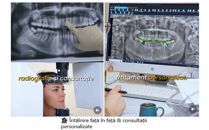 Poliția a intrat pe fir după sesizarea Colegiului Medicilor Stomatologi despre clinica din Turcia care ar fi promis consultații la un... hotel din Cluj