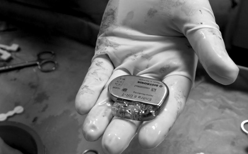 Cardiologi trimiși în judecată pentru că au implantat pacienților stimulatoare cardiace extrase de la cadavre