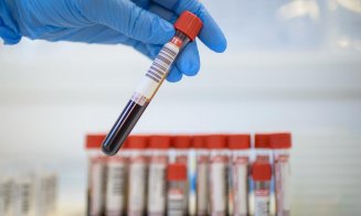 Analize medicale gratuite, fără goana de la începutul lunii: CNAS pregătește eliminarea plafoanelor