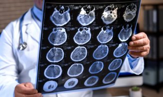 Densitatea osoasă scăzută, legată de declinul cognitiv. Ce au descoperit cercetătorii